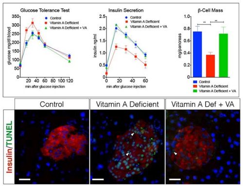 Εικόνες από το πάγκρεας υποκειμένων της έρευνας: ομάδας ελέγχου με κανονικά ποντίκια με επάρκεια βιταμίνης Α (αριστερά), με ανεπάρκεια βιταμίνης Α (μέση)-[που έχει υψηλό αριθμό νεκρών βήτα κυττάρων (πράσινο) και χαμηλή ινσουλίνη (κόκκινο)]-και υποκείμενα στα οποία επαναχορηγήθηκε βιταμίνη Α (δεξιά).