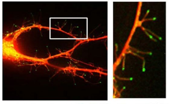 Φθορίζουσα μικροφωτογραφία νευρώνα όπου φαίνονται νηματοπόδια που προεκτείνονται από δενδρίτη (Η εικόνα από Webb Lab/Vanderbilt)