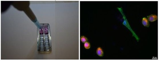 Εικόνα 1.α: Απεικόνιση του μικροσυστήματος Εικόνα 1.β: Εικόνα μικροσκοπίου φθορισμού από συγκαλλιέργεια φυσιολογικών και καρκινικών κυττάρων σε κατεργασμένη επιφάνεια στο πλάσμα