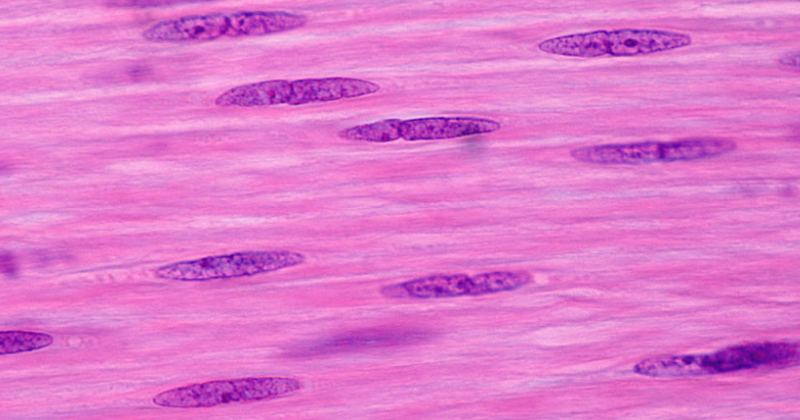 Νέες ελπίδες για ασθένειες που σχετίζονται με τους μύες με μετατροπή δερματικών κυττάρων;